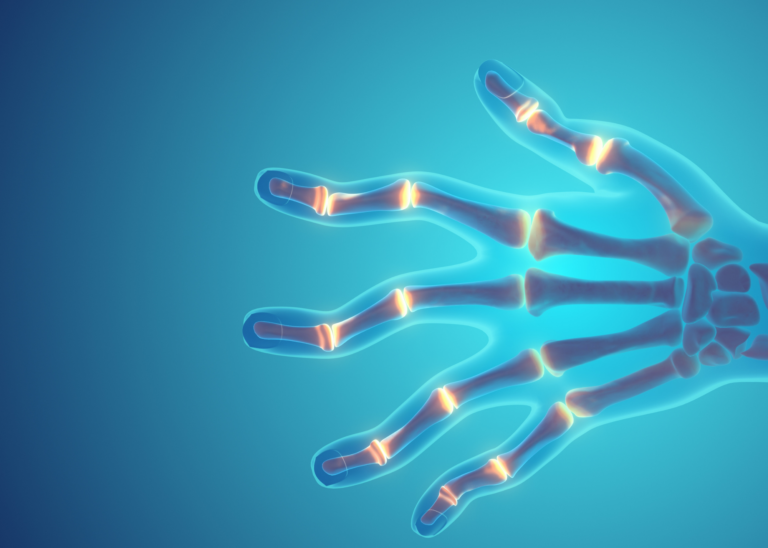 arthritis injuries solution via stem cell treatments