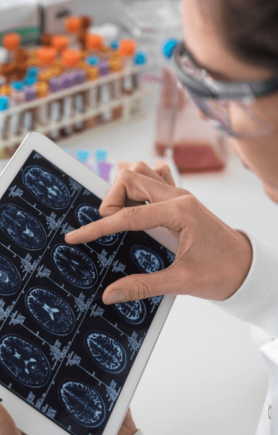 Stem-Cell-Research Stem cell scientist analysing Neurological images