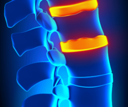 Illustrative image showing back and spine issues.
