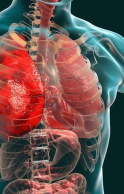 Pulmonary-Fibrosis-Relief Illustrative image of human heart and the body.